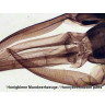 Набор микропрепаратов BRESSER 25 шт., в кейсе 74560